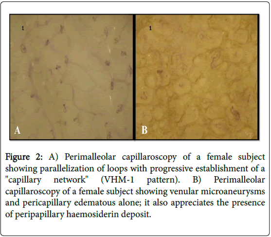 Angiology-Perimalleolar-capillaroscopy