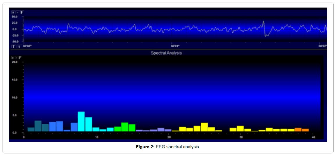 Ergonomics-EEG-spectral-analysis