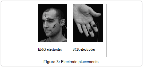 Ergonomics-Electrode-placements