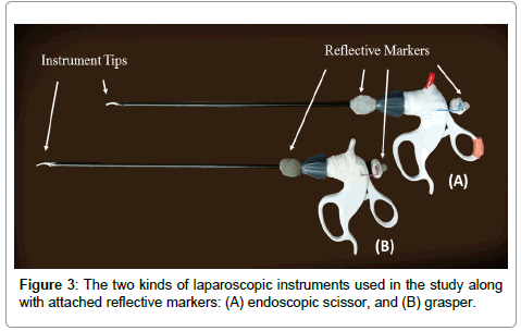 Ergonomics-endoscopic-scissor
