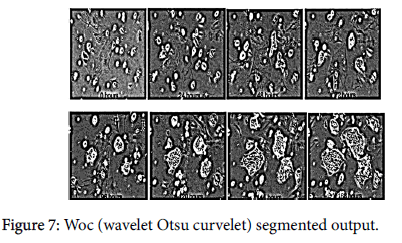advancements-genetic-engineering-wavelet-Otsu-curvelet