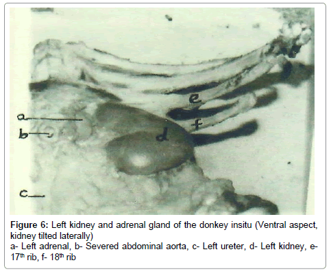anatomy-physiology-Left-kidney