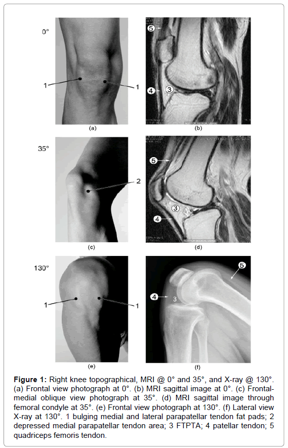 anatomy-physiology-Right-knee-topographical