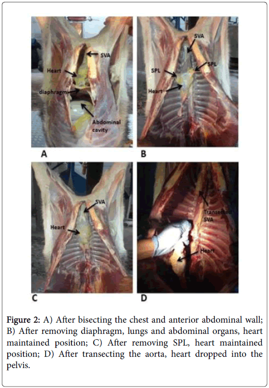 anatomy-physiology-abdominal-wall