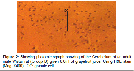anatomy-physiology-grapefruit-juice