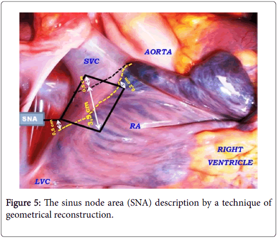 anatomy-physiology-node-area