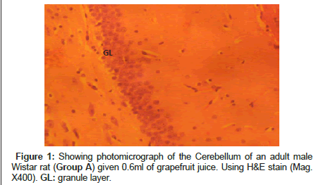 anatomy-physiology-photomicrograph-Cerebellum