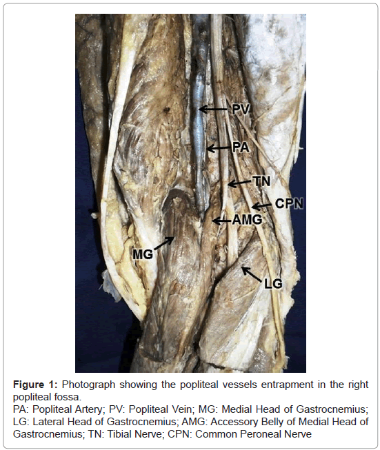 anatomy-physiology-popliteal-vessels