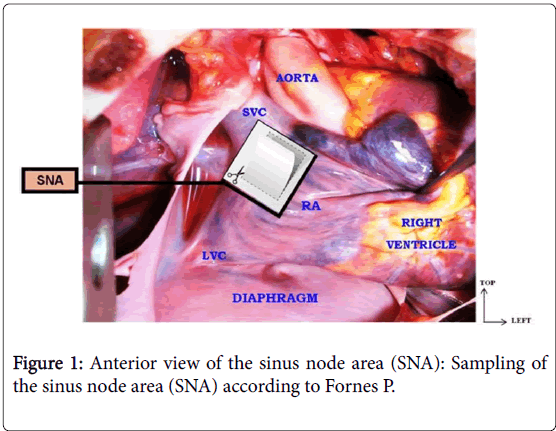 anatomy-physiology-sinus-node