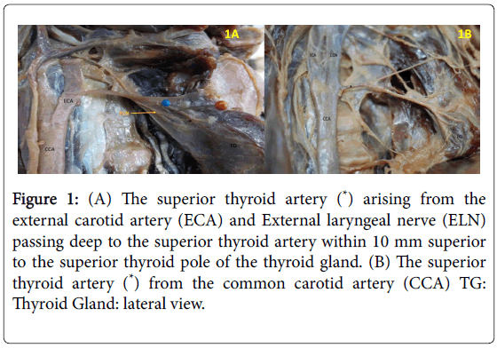 anatomy-physiology-thyroid-artery