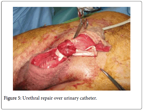 anatomy-physiology-urinary-catheter