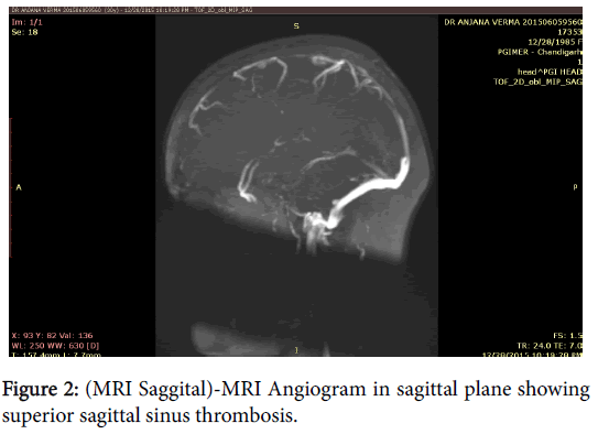 anesthesia-clinical-research-Angiogram-sagittal