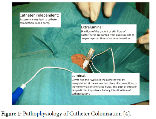anesthesia-clinical-research-Catheter-Colonization