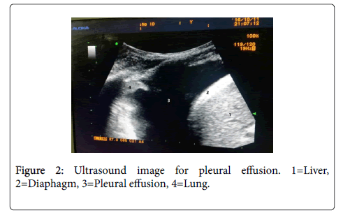 anesthesia-clinical-research-Ultrasound-image