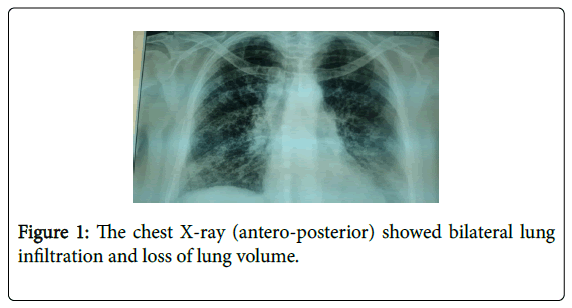 anesthesia-clinical-research-lung-volume