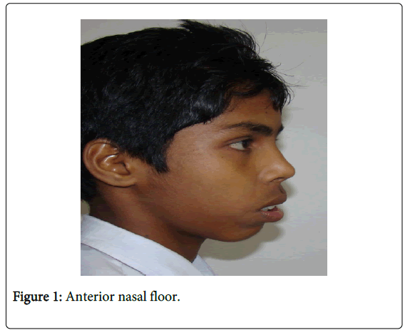 anesthesia-clinical-research-nasal-floor