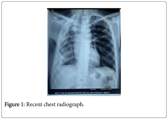 anesthesia-clinical-research-radiograph