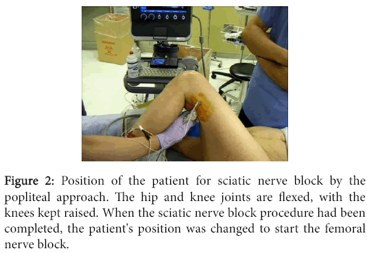 sciatic nerve block anterior approach