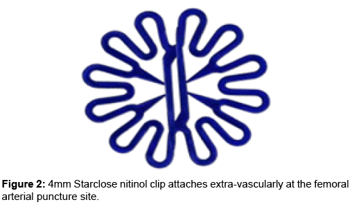 angiology-4mm-Starclose-nitinol-clip-attaches