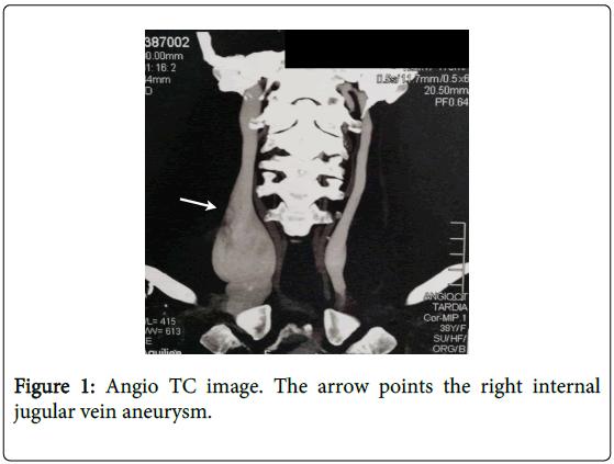 angiology-Angio-TC-image-arrow-points