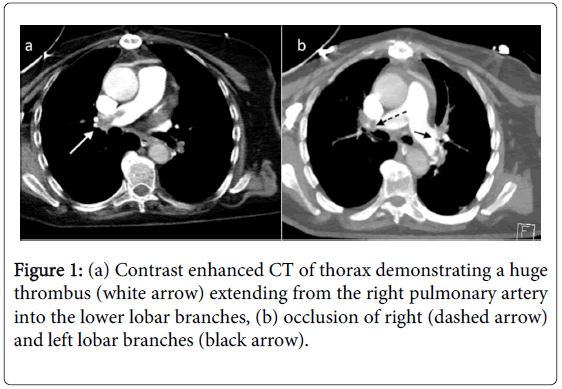angiology-Contrast-enhanced-CT-thorax