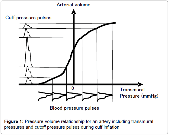 angiology-Pressure-volume-relationship-artery