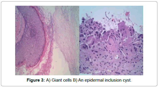 Archive Womens Health Care Epidermal Inclusion