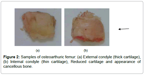 bone-marrow-research-osteoarthuric-femur