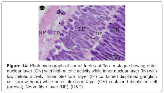 cell-developmental-Inner-plexiform-layer