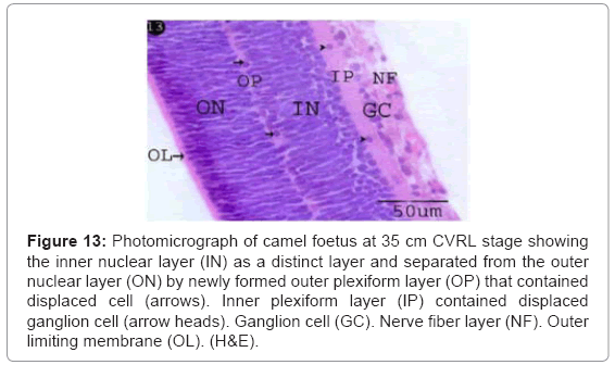 cell-developmental-Nerve-fiber-layer
