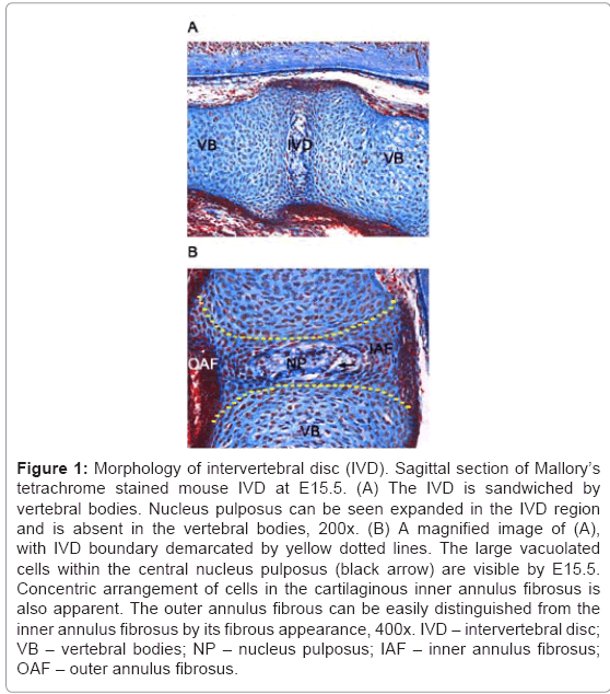 cell-developmental-intervertebral-disc