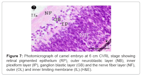 cell-developmental-pigmented-epithelium