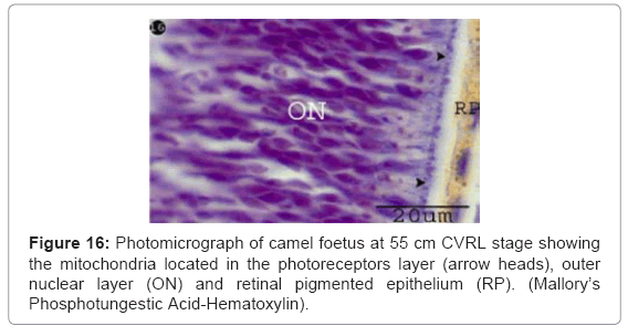 cell-developmental-pigmented-epithelium