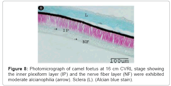 cell-developmental-plexiform-layer