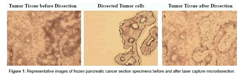 cell-science-therapy-frozen-pancreatic