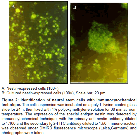 cell-science-therapy-neural-stem-cells