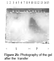 chromatography-separation-techniques-Photography-gel