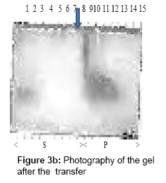 chromatography-separation-techniques-Photography-gel