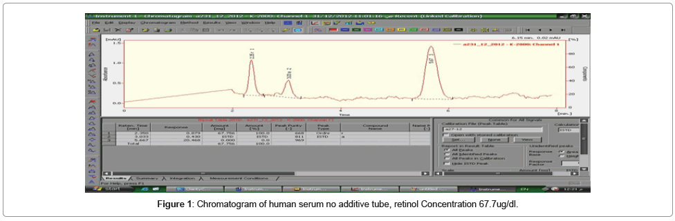 chromatography-separation-techniques-human-serum