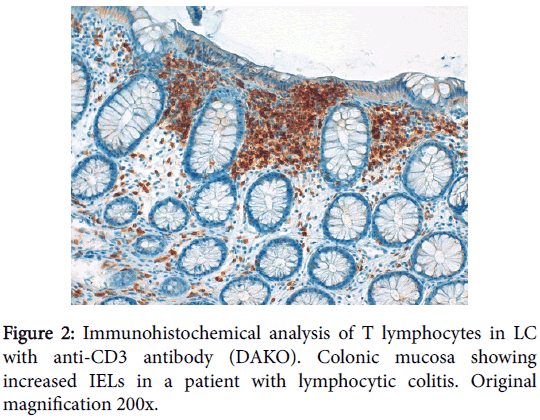 clinical-cellular-immunology-Immunohistochemical-analysis
