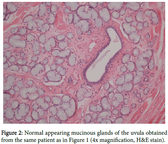 clinical-cellular-immunology-Normal-appearing