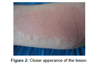clinical-dermatology-Closer-apperance