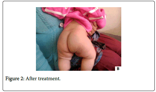 clinical-dermatology-after-treatment