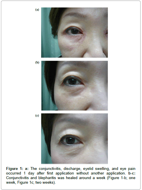 clinical-dermatology-eyelid-swelling