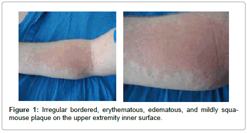 clinical-dermatology-inner-surface