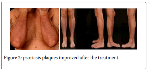 clinical-dermatology-plaques-improved