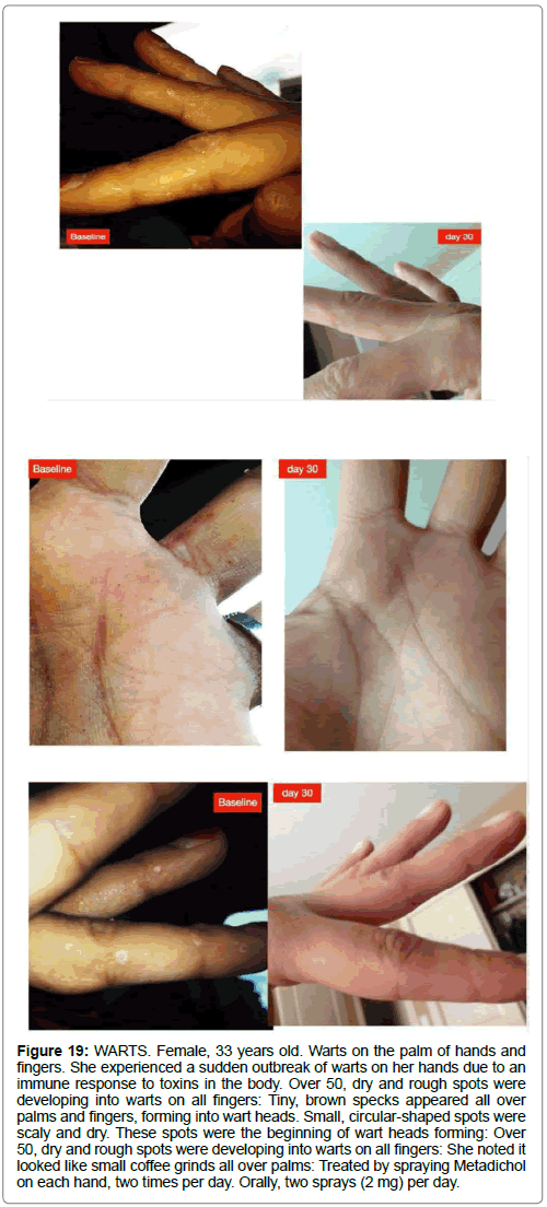 clinical-dermatology-rough-spots