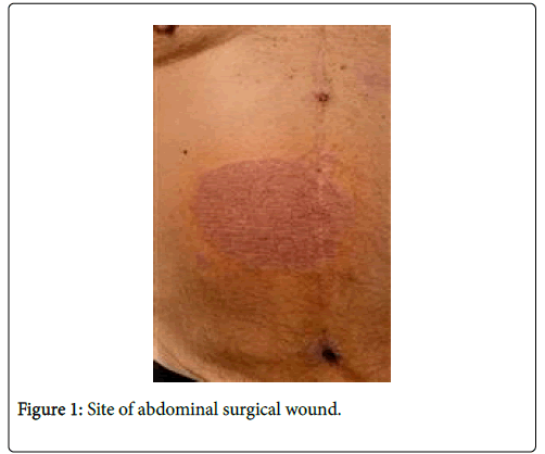 clinical-dermatology-surgical-wound