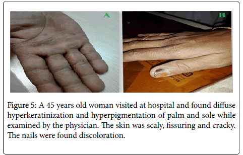 Evaluation of Nail Abnormalities | AAFP