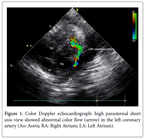 clinical-experimental-cardiology-Color-Doppler
